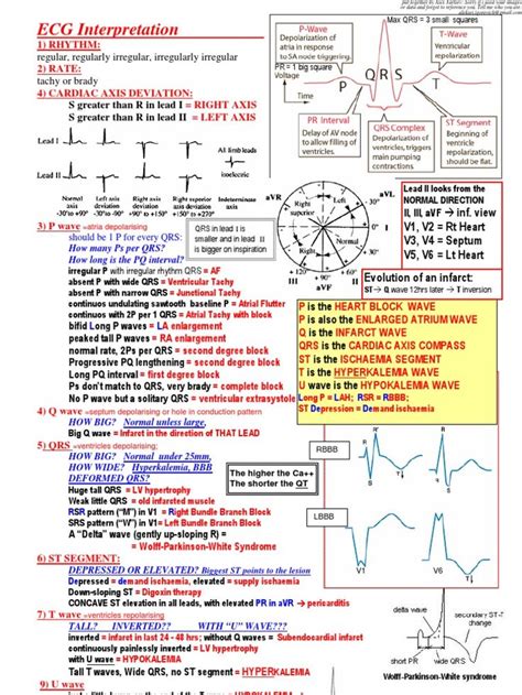 ecg for dummies|Master ECG Interpretation .